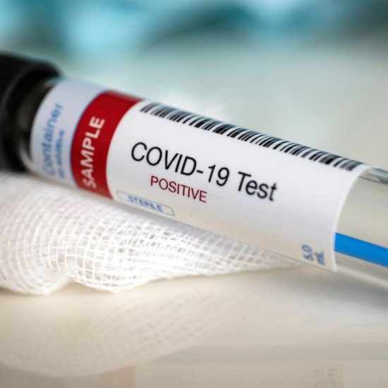 COVID-19 тест-системы, используемые в Украине, обнаруживают новый штамм вируса