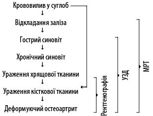 Диагностика гемофилической артропатии