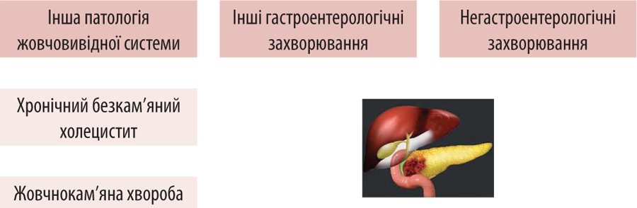 Болевой синдром при билиарной дисфункции: тактика менеджмента пациентов в свете современных гайдлайны