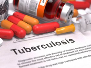 Планируется международная аккредитация украинских лабораторий по диагностике туберкулеза