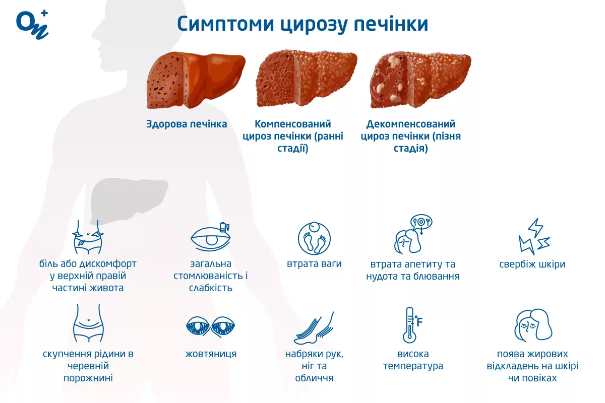 цироз печінки